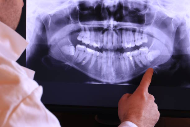 Best Same-Day Emergency Dentist in Aubrey, TX