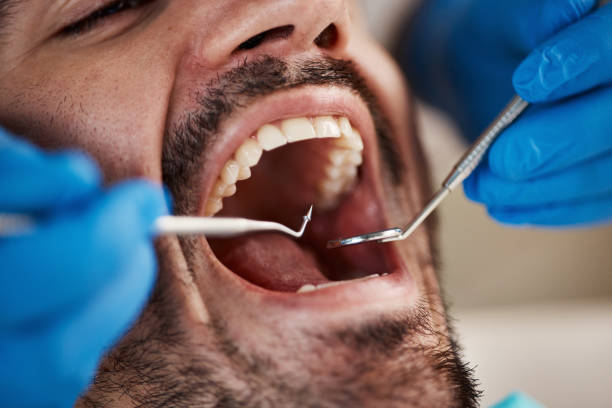 Best After-Hours Emergency Dentist in Aubrey, TX